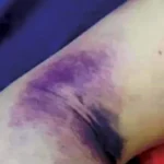 حرائق غابات كندا تطرد 21 ألفا من منازلهم